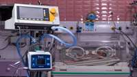 The first treatment of ROP in a premature infant in ventilator in Semnan University of Medical Sciences and Health Services