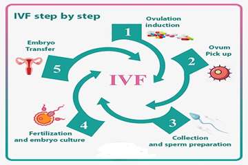 semums-en.amirhos.ivf ward 